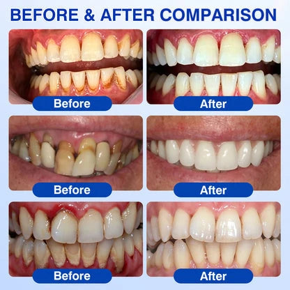 Periodontal care gel formula