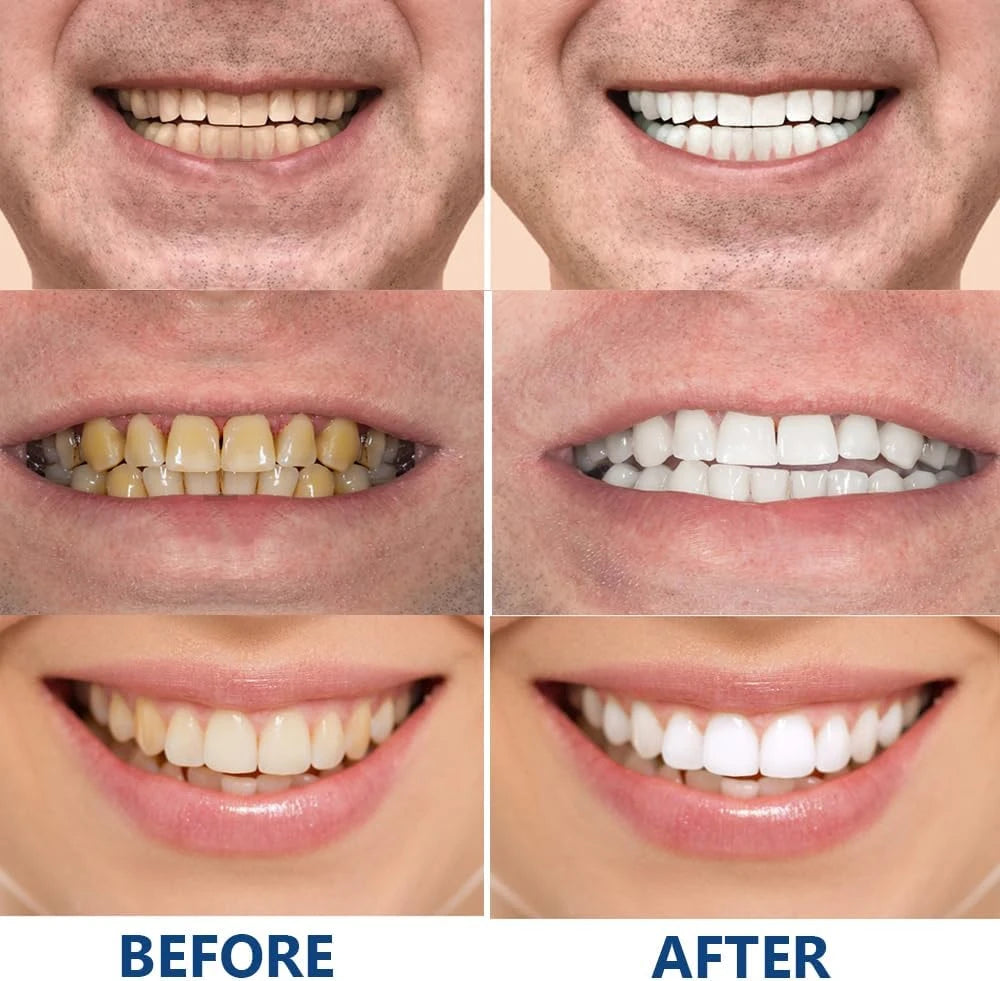 Hydroxyapatite  Repair Toothpaste